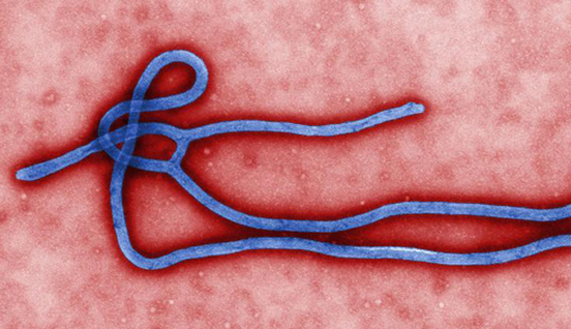 警惕最新病毒病人，你需要了解這些關(guān)鍵信息！