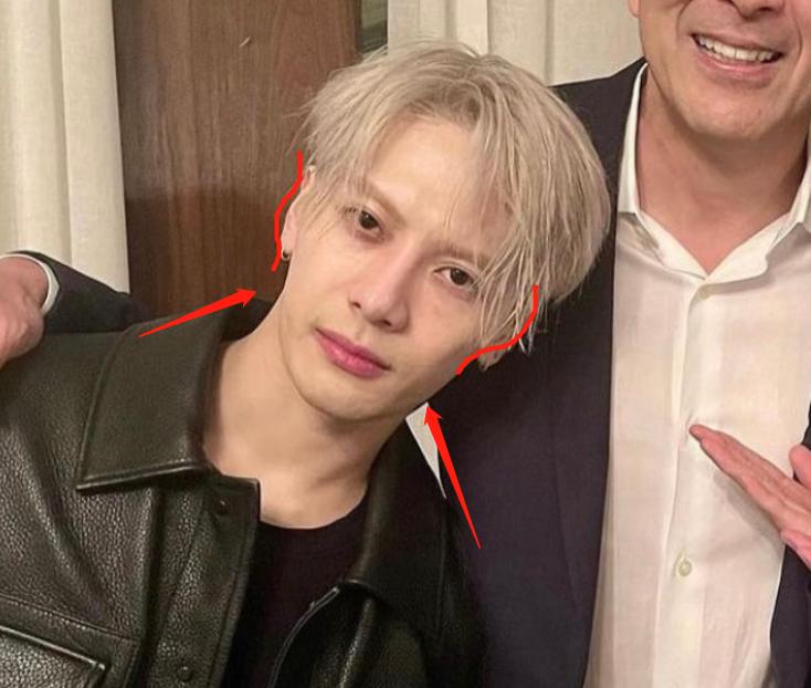 深度解析明星整容后遺癥，觀點與影響探討